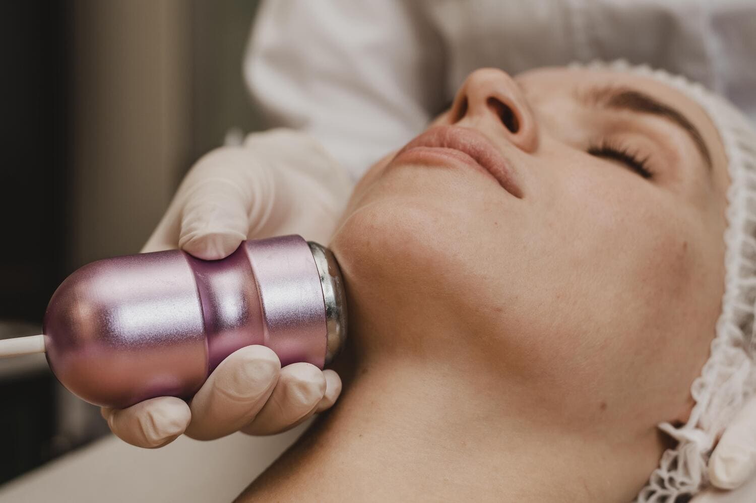 Foto Radiofrecuencia Facial